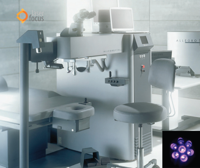 Excimer laser za izrazito nepravilne rožnjače