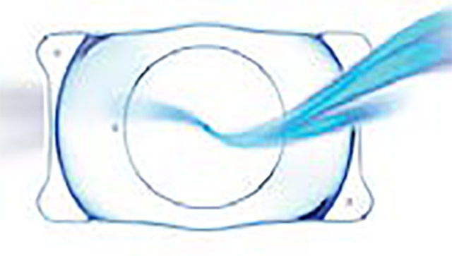 ICL model v4c CentraFLOW