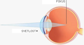kratkovidost