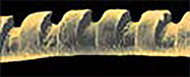 Preciznost lasera na ljudskoj dlaci